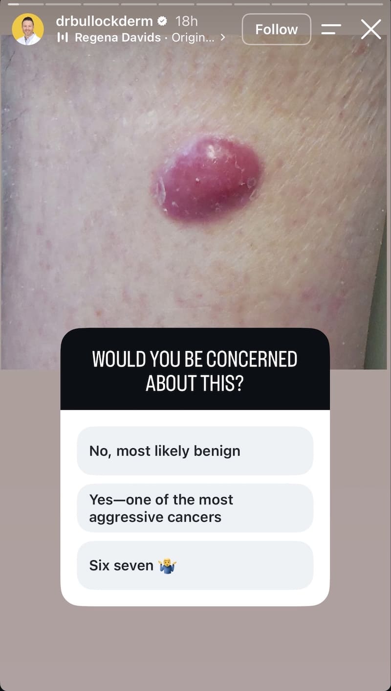 Close-up of raised skin lesion with 'Would you be concerned about this?' three-option diagnostic quiz.